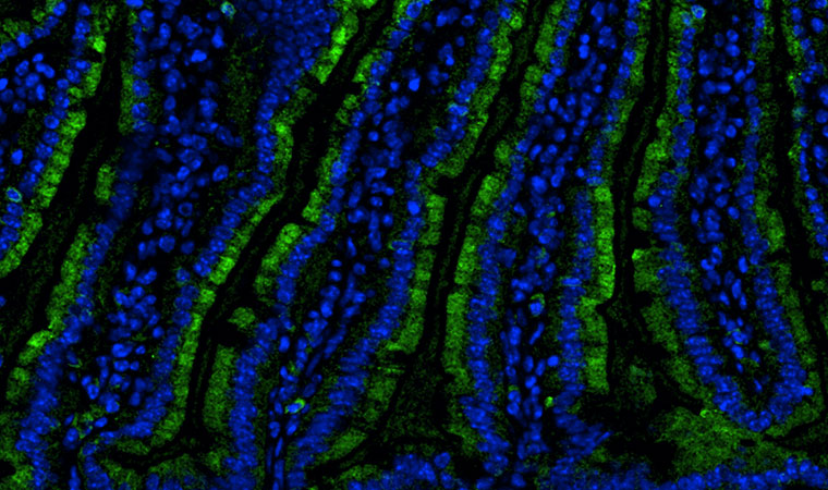 Microbiome Research: Jeffrey